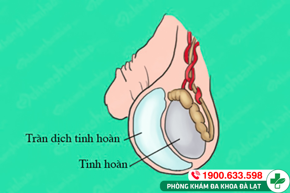 Block Image