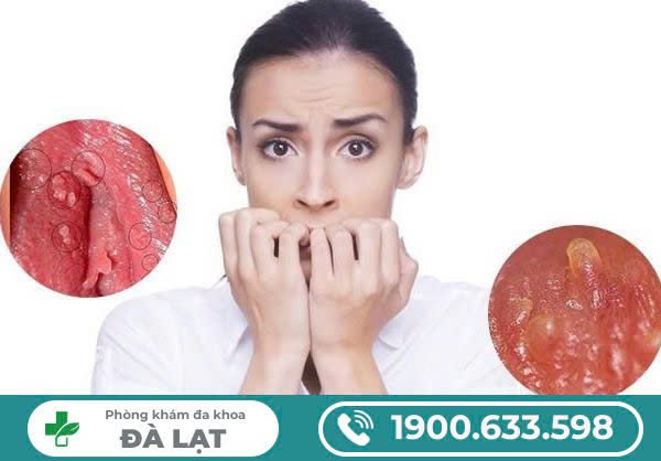 VÙNG KÍN XUẤT HIỆN MỤN THỊT, NGUYÊN NHÂN VÀ CÁCH XỬ LÝ?