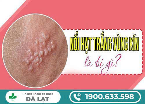 Môi "Cô bé" bị nổi hạt mẩn ngứa? Những điều bạn cần tìm hiểu ngay?