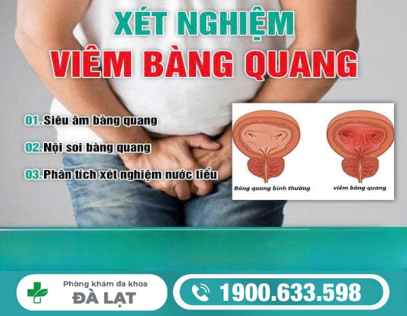 NAM GIỚI BỊ VIÊM BÀNG QUANG CẦN LÀM NHỮNG XÉT NGHIỆM NÀO?