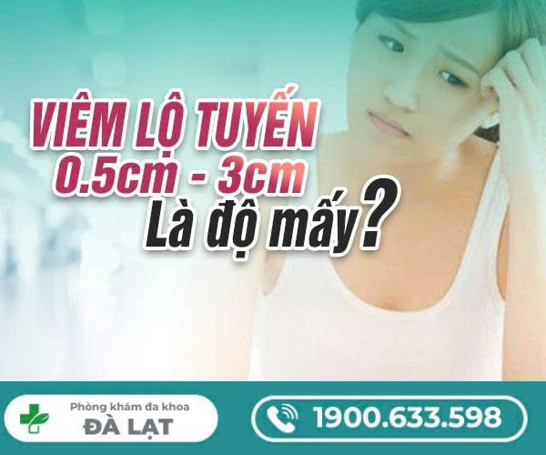 Viêm Lộ Tuyến 0,5cm - 3cm Là Độ Mấy? 