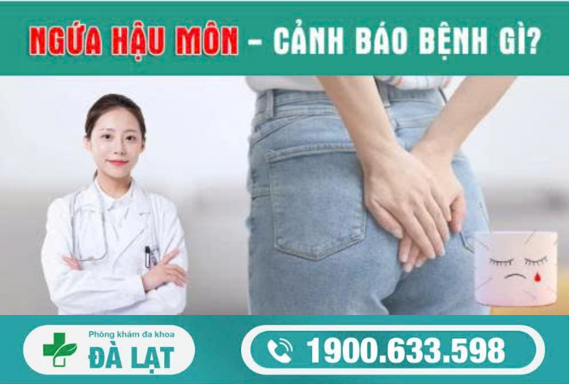 CÁCH CHỮA NGỨA HẬU MÔN HIỆU QUẢ HIỆN NAY        