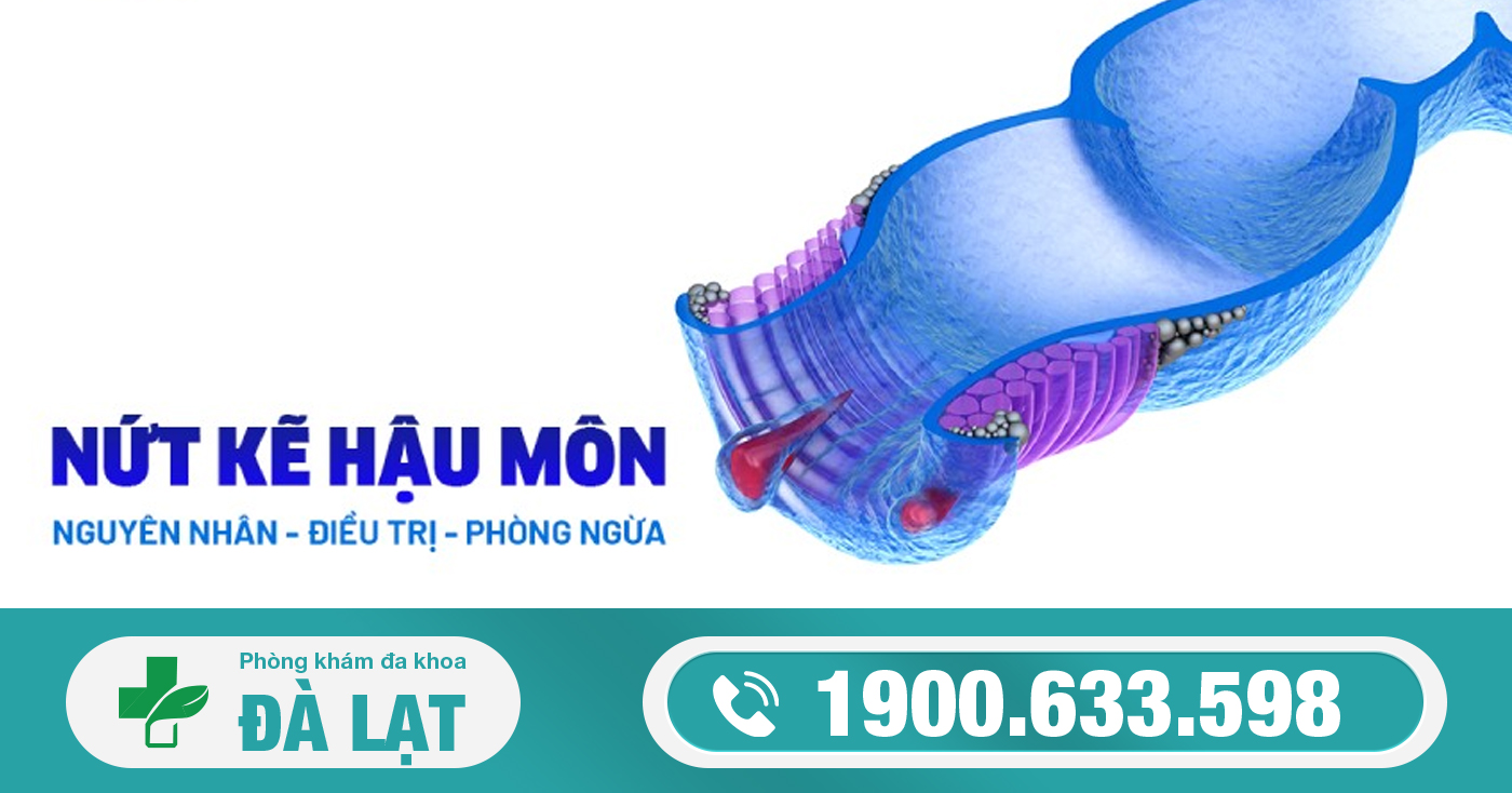 TÌM HIỂU CÁCH CHỮA NỨT KẼ HẬU MÔN HIỆU QUẢ     
