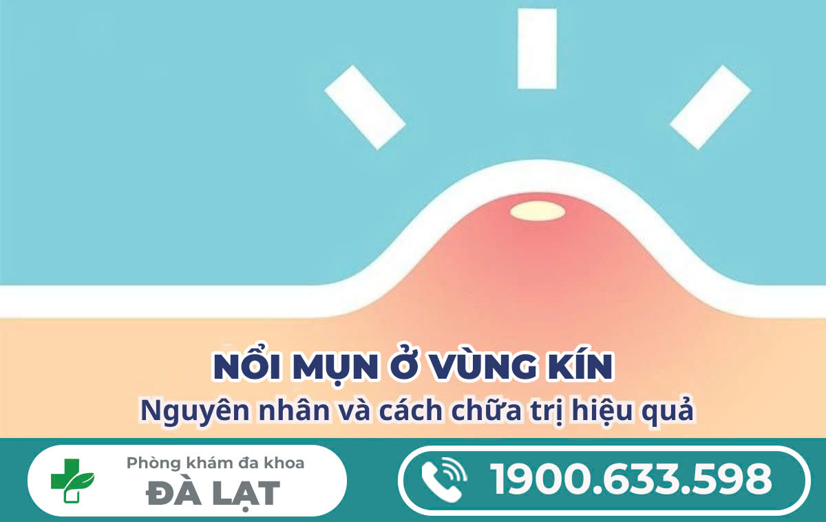 Nguyên nhân gây các loại mụn ở sinh dục nam và nữ giới