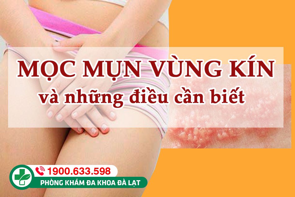 Cùng tìm hiểu nguyên nhân gây các loại mụn ở sinh dục nam và nữ giới
