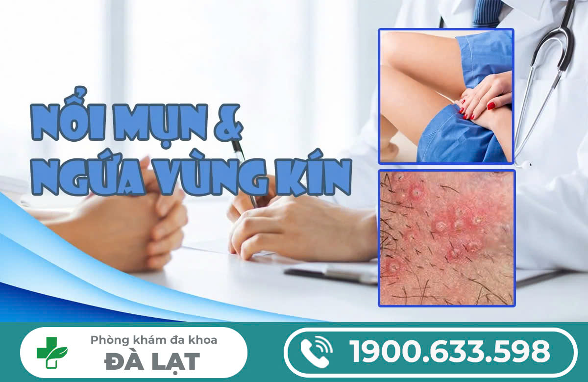 Mụn sinh dục ở nam & nữ giới: Tác hại và phương pháp điều trị mụn sinh dục