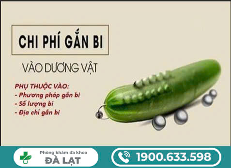 CHI PHÍ GẮN BI BAO NHIÊU?