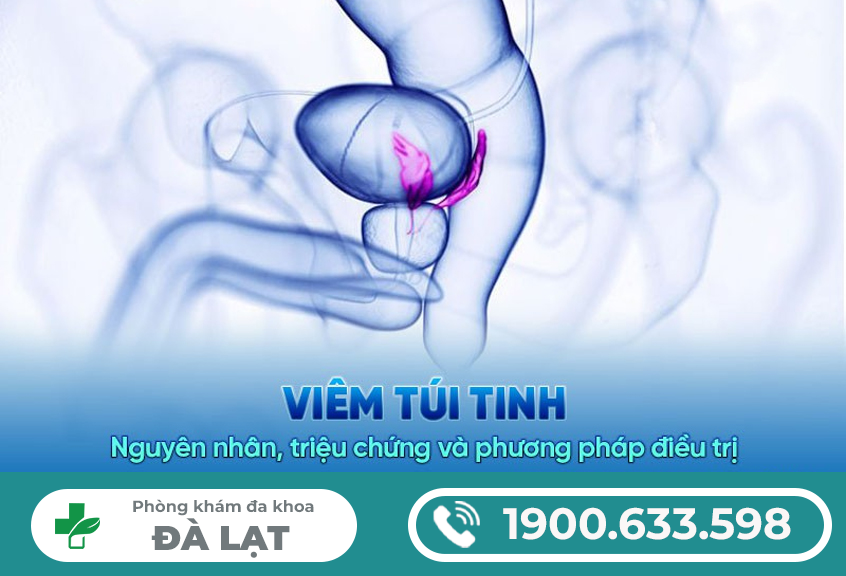 NGUYÊN NHÂN GÂY VIÊM TÚI TINH