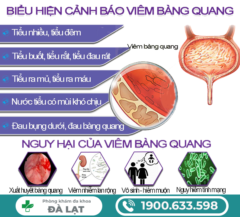 VIÊM BÀNG QUANG: Nguyên nhân, Biểu hiện, Biến chứng, Cách điều trị