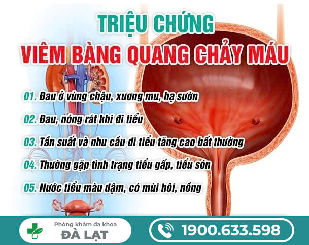 VIÊM BÀNG QUANG CHẢY MÁU