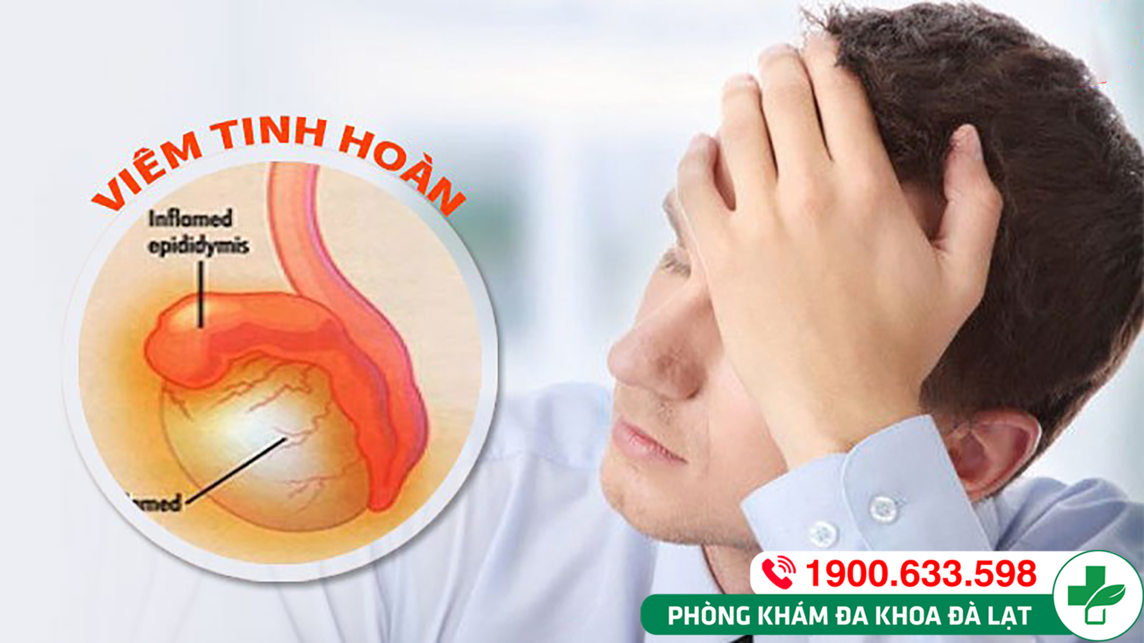 CHIA SẺ VỀ VIÊM TINH HOÀN MỘT BÊN