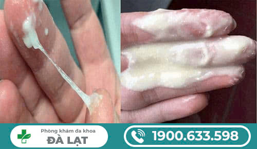 NHỮNG ĐIỀU CẦN BIẾT VỀ BỰA SINH DỤC, NGUYÊN NHÂN VÀ CÁCH ĐIỀU TRỊ?
