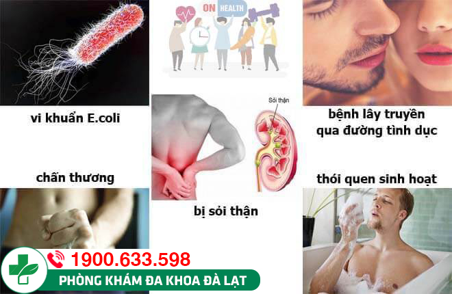 TIỂU RẮT RA MÁU LÀ GÌ? NGUYÊN NHÂN VÀ PHƯƠNG PHÁP ĐIỀU TRỊ HIỆU QUẢ