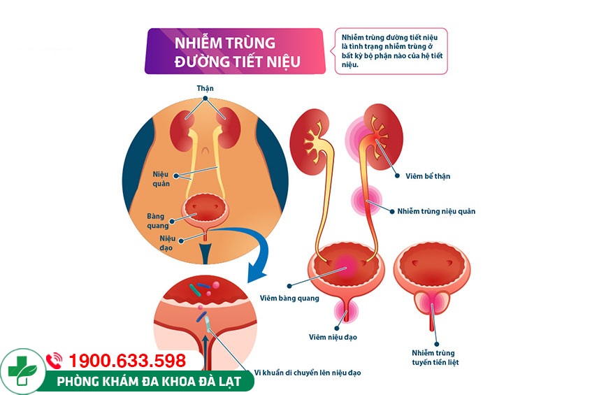 TỔNG QUÁT VỀ HIỆN TƯỢNG TIỂU BUỐT Ở NAM GIỚI VÀ NỮ GIỚI