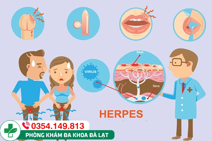 Mụn rộp sinh dục nam biểu hiện thế nào và có nguy hiểm không?