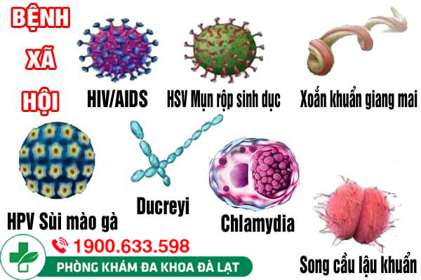 Các bệnh tình dục ở nữ là gì? Dấu hiệu bệnh tình dục ở nữ