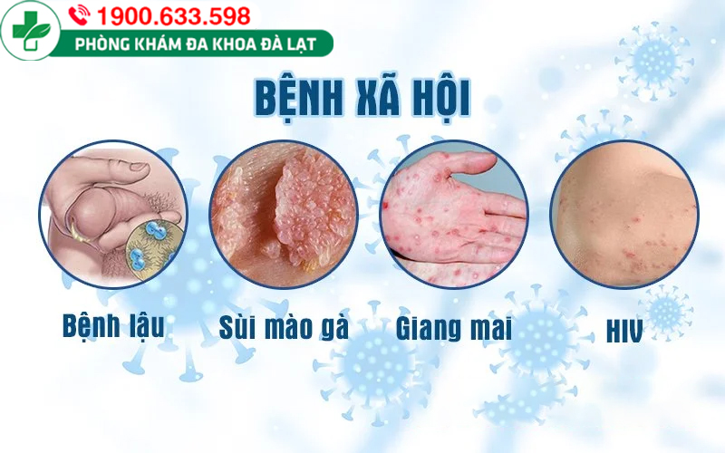 Những điều cần biết về căn bệnh xã hội