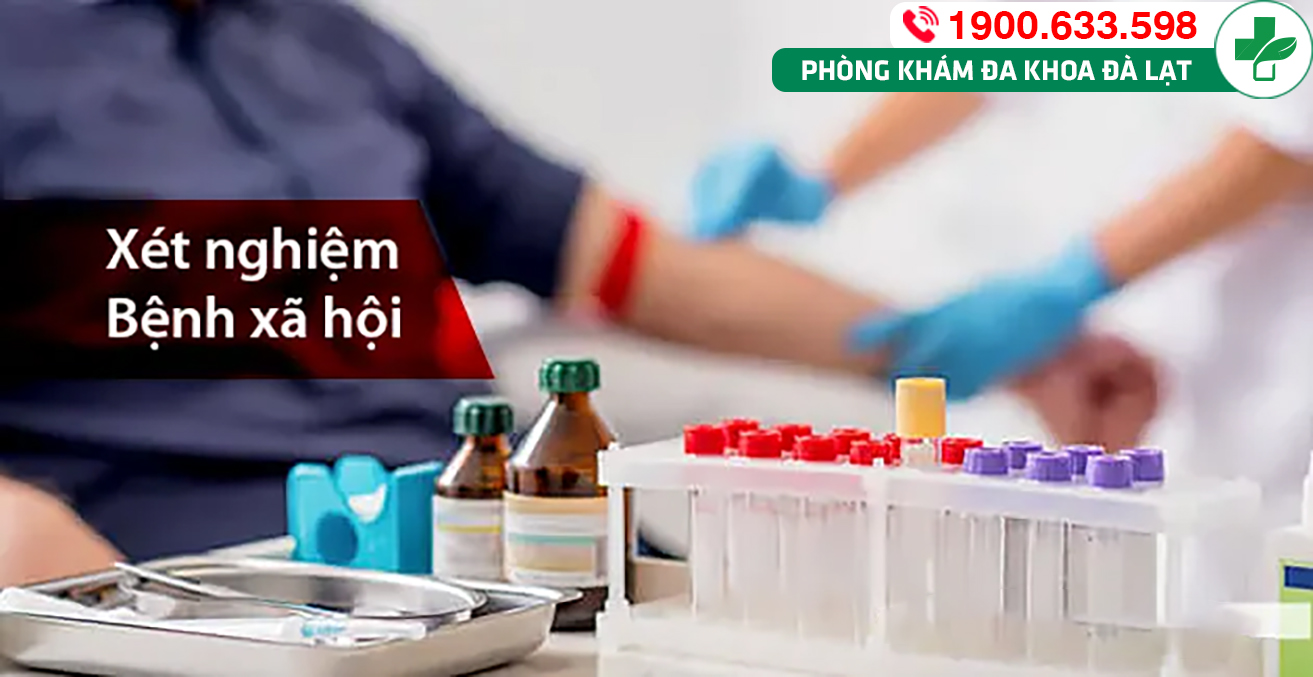 Xét nghiệm bệnh xã hội: Vai trò và phương pháp thực hiện