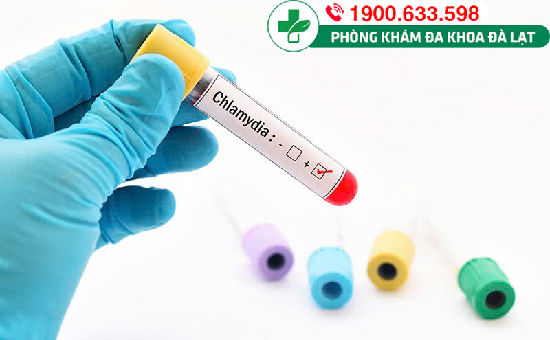 Xét nghiệm chẩn đoán bệnh Chlamydia dương tính