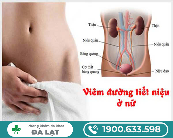 VIÊM ĐƯỜNG TIẾT NIỆU Ở NỮ GIỚI: NGUYÊN NHÂN – TRIỆU CHỨNG – CÁCH ĐIỀU TRỊ TOÀN DIỆN