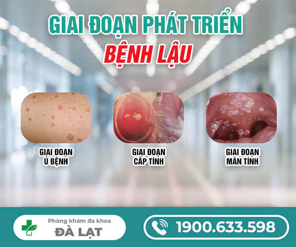 TÌM HIỂU BỆNH LẬU VÀ CÁCH CHỮA TRỊ HIỆU QUẢ NHẤT HIỆN NAY