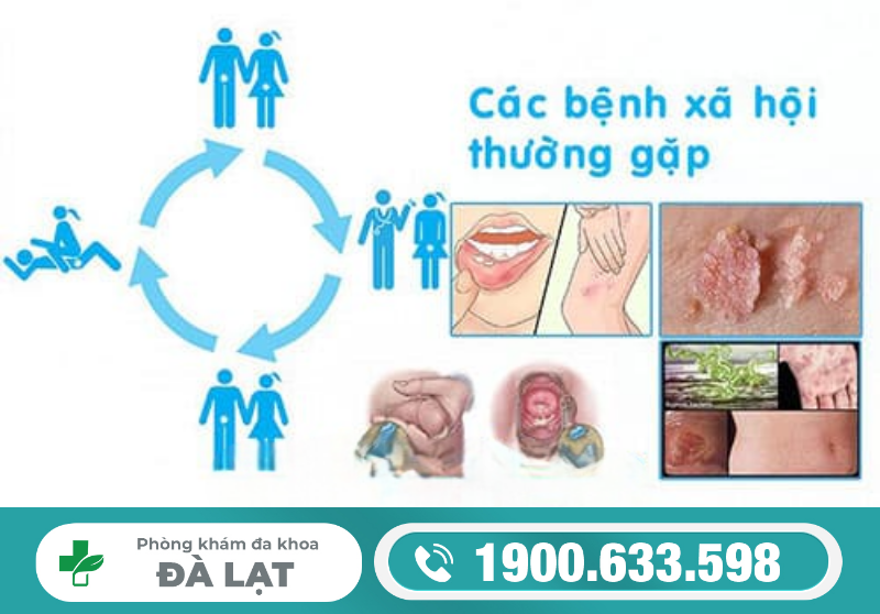 BỆNH XÃ HỘI LÀ GÌ?