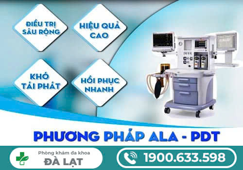 TỔNG HỢP 5 PHƯƠNG PHÁP CHỮA SÙI MÀO GÀ HIỆN NAY