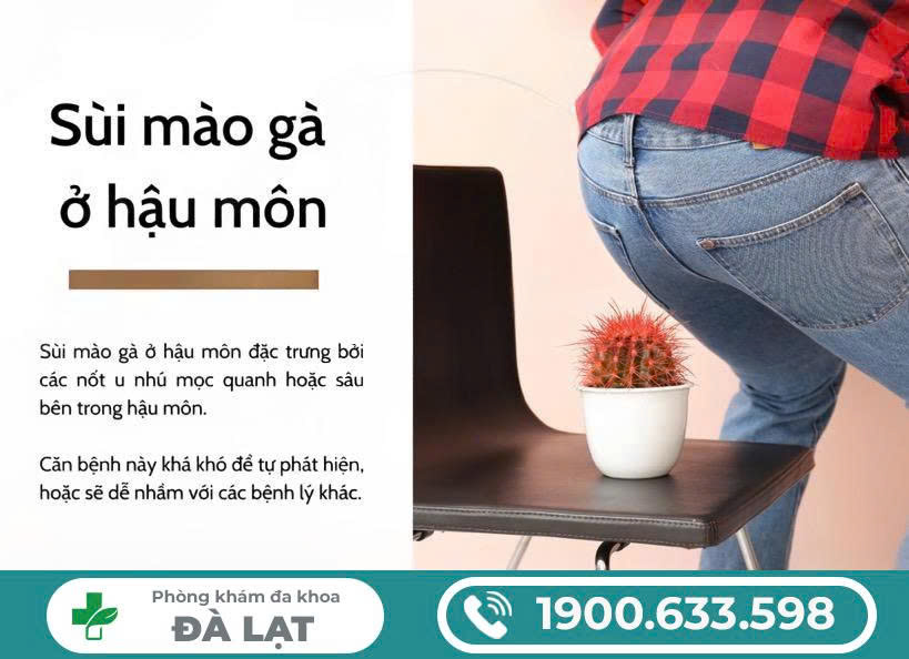 TÌM HIỂU SÙI MÀO GÀ Ở HẬU MÔN NAM GIỚI & NỮ GIỚI