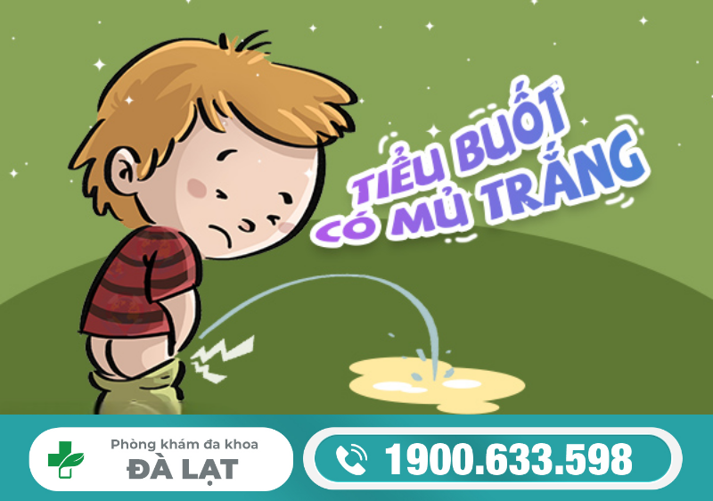 ĐI TIỂU BUỐT KÈM MỦ TRẮNG LÀ DẤU HIỆU CẢNH BÁO BỆNH GÌ?