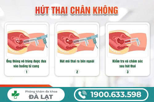 PHÁ THAI NGOẠI KHOA LÀ GÌ?
