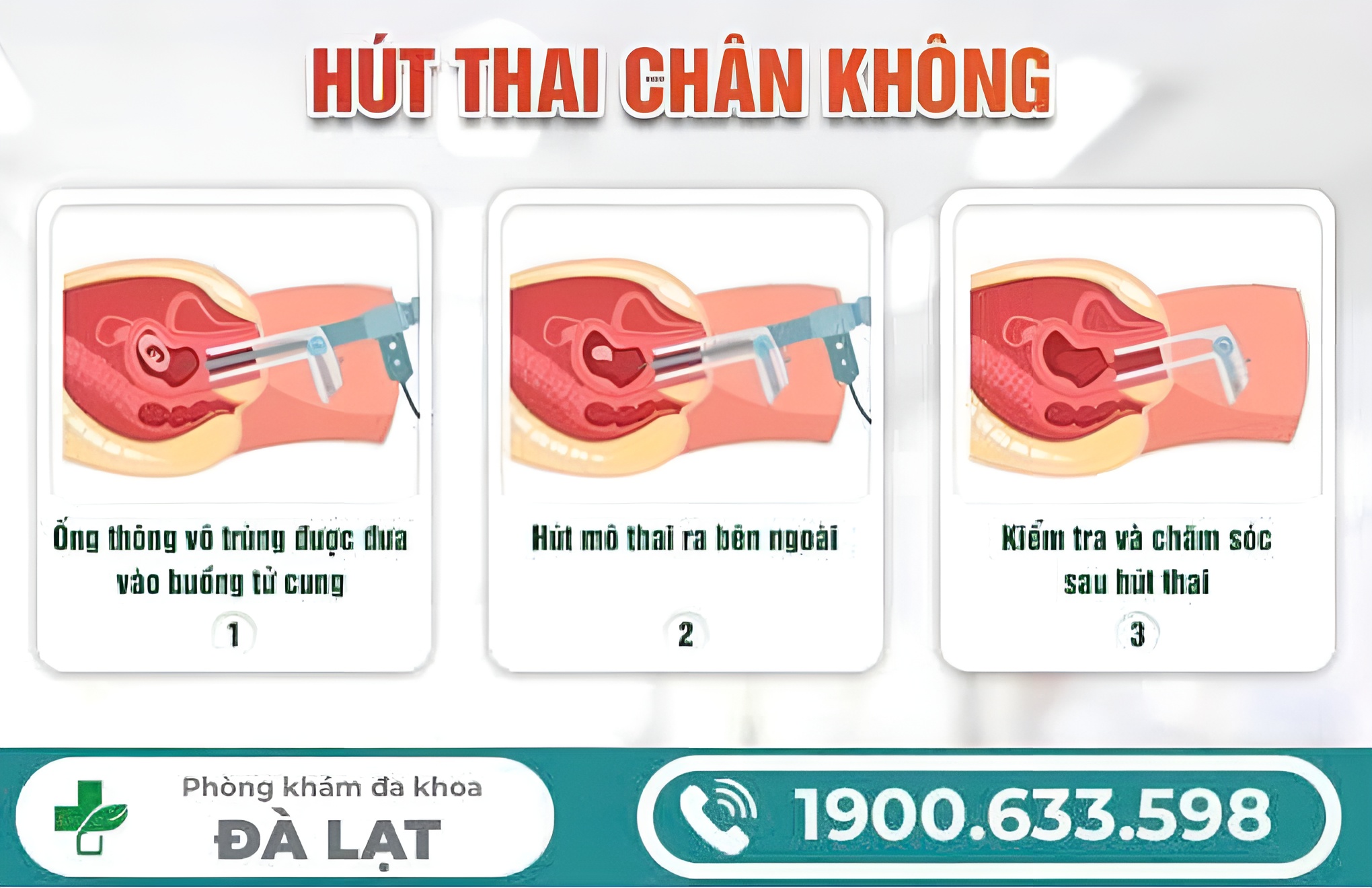 PHÁ THAI 2 THÁNG TUỔI