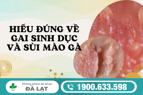 NHẬN BIẾT GAI SINH DỤC VÀ SÙI MÀO GÀ: ĐỪNG NHẦM LẪN