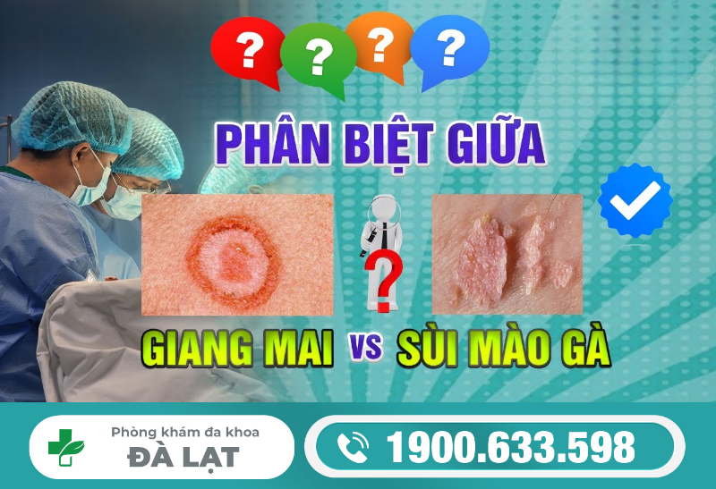 GIANG MAI VÀ SÙI MÀO GÀ: HAI BỆNH XÃ HỘI NGUY HIỂM THƯỜNG GẶP