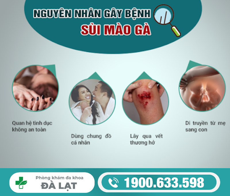 MỤN SINH DỤC VÀ SÙI MÀO GÀ KHÁC NHAU NHƯ THẾ NÀO?