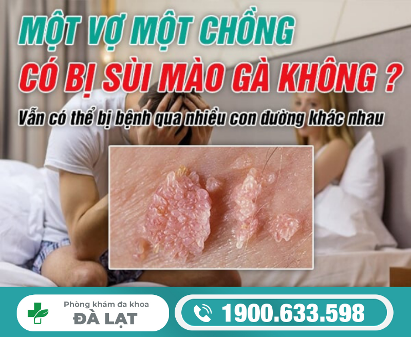 QUAN HỆ AN TOÀN, MỘT VỢ MỘT CHỒNG CÓ BỊ SÙI MÀO GÀ KHÔNG?