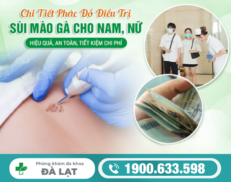 PHÁC ĐỒ ĐIỀU TRỊ SÙI MÀO GÀ: HIỆU QUẢ, AN TOÀN, TIẾT KIỆM CHI PHÍ