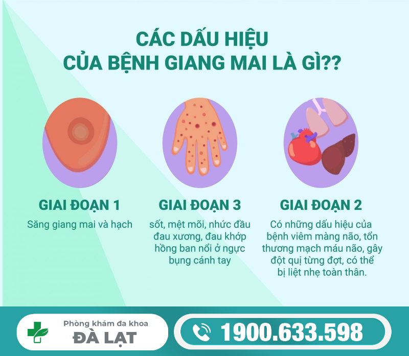 NHẬN BIẾT DẤU HIỆU BỆNH GIANG MAI QUA TỪNG GIAI ĐOẠN