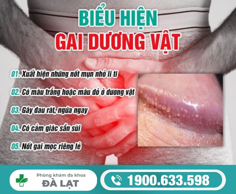 GAI DƯƠNG VẬT LÀ GÌ? DẤU HIỆU NHẬN BIẾT VÀ CÁCH ĐIỀU TRỊ
