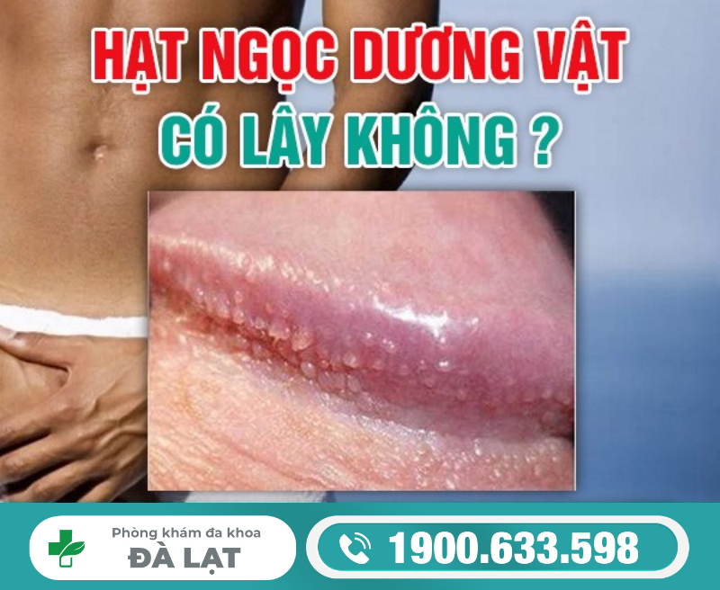 HẠT NGỌC DƯƠNG VẬT CÓ LÂY KHÔNG? GIẢI ĐÁP THẮC MẮC CHO NAM GIỚI