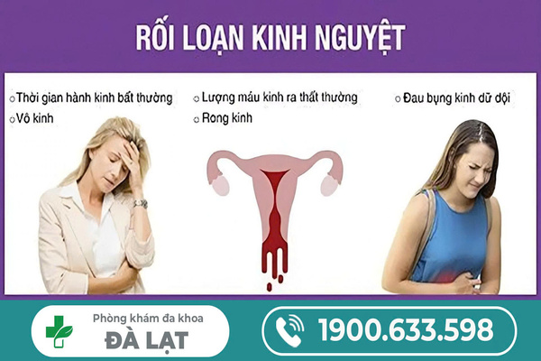 Tìm Hiểu: Bệnh Rối Loạn Kinh Nguyệt 