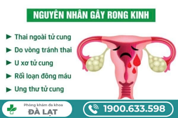 Rong Kinh Là Gì: Nguyên Nhân, Triệu Chứng và Biến Chứng 
