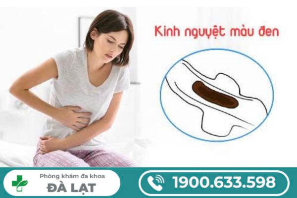 Hiện Tượng Kinh Nguyệt Màu Đen 