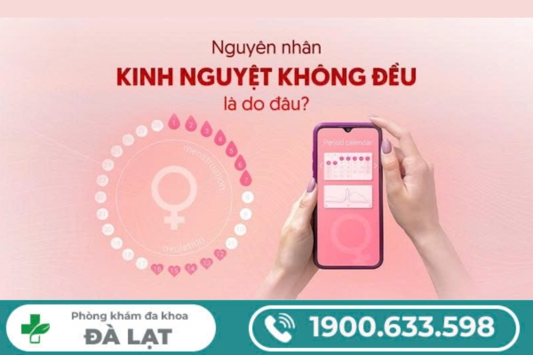 Tìm Hiểu Về: Kinh Nguyệt Không Đều