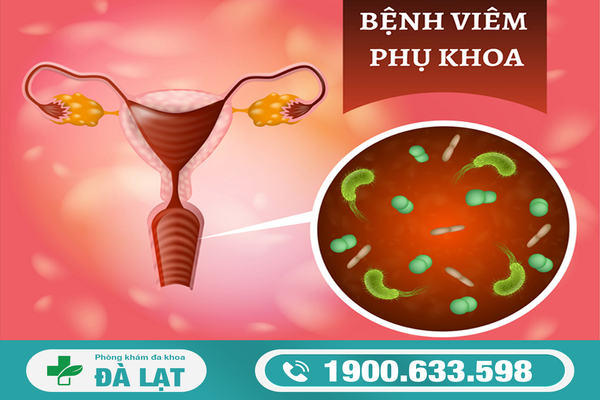 Tìm Hiểu Về: Bệnh Viêm Phụ Khoa 