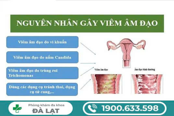 Nguyên Nhân Gây Ra Viêm Âm Đạo 