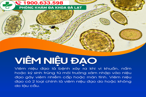 VIÊM NIỆU ĐẠO Ở NỮ GIỚI: KHI NÀO CẦN ĐI KHÁM BÁC SĨ 
