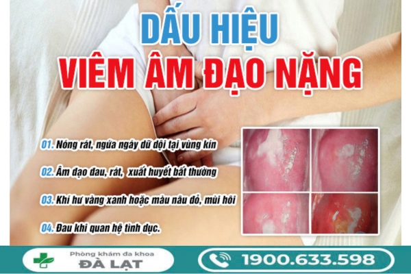 Bị Viêm Âm Đạo Nặng Là Như Thế Nào? 
