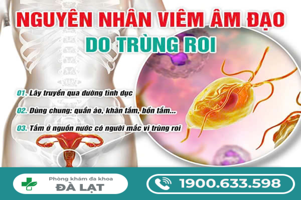 Viêm Âm Đạo Do Trùng Roi