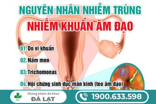 Nhiễm Trùng, Nhiễm Khuẩn Âm Đạo 