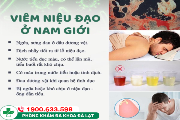 BỆNH VIÊM NIỆU ĐẠO Ở NAM GIỚI: TRIỆU CHỨNG, NGUYÊN NHÂN VÀ CÁCH ĐIỀU TRỊ 
